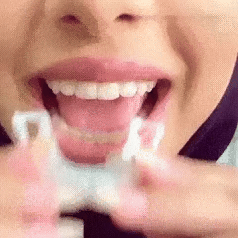 Zâmbet perfect DentalTeeth